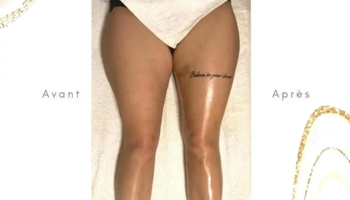 Drainage Lymphatique Renata França Luxembourg - Massage Luxembourg - Lyne Studio - Ville-Haute Luxembourg